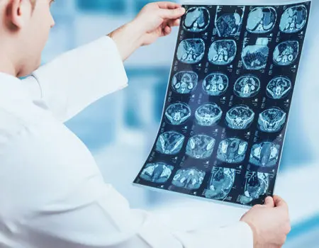 Doctor looking MRI picture.